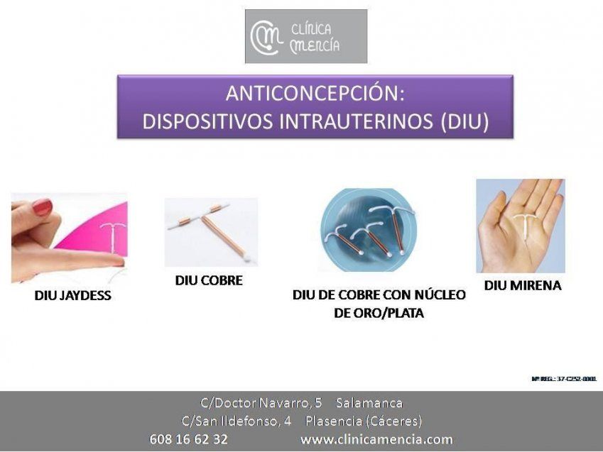 Test de embarazo discount con diu mirena