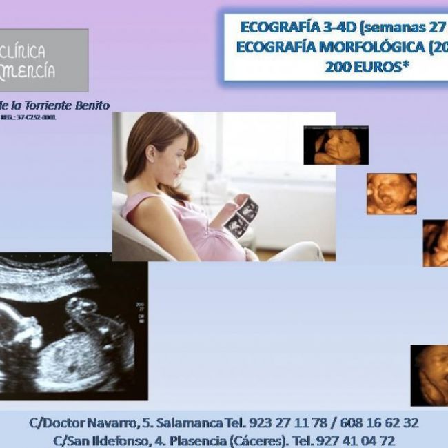 ECO 20S Y 3 4D