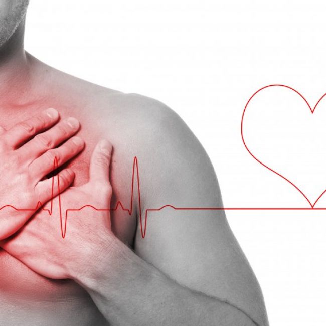 cardiovascular