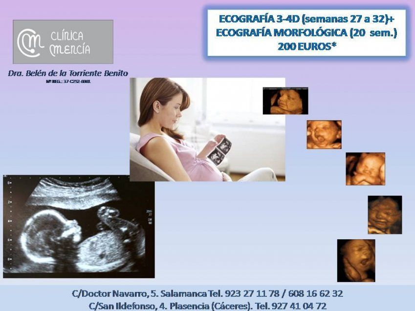 ECO 20S Y 3 4D ECO 20S Y 3 4D