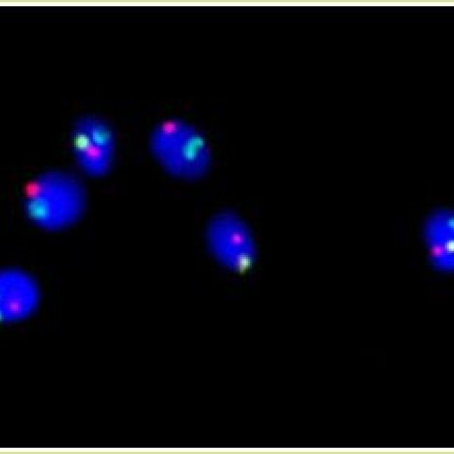 estudio avanzado en el varón