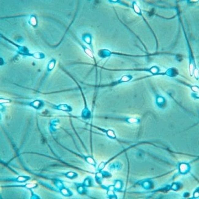 congelación de semen