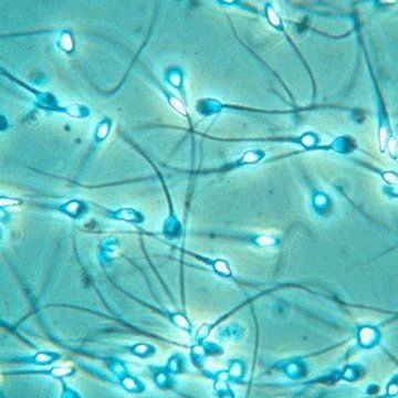 congelación de semen