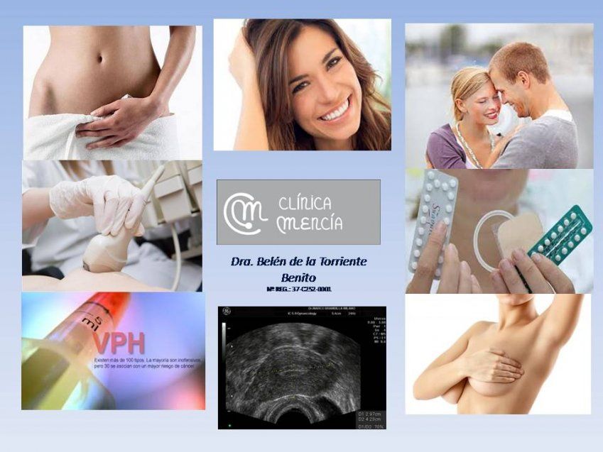 REVISIÓN GINECOLÓGICA