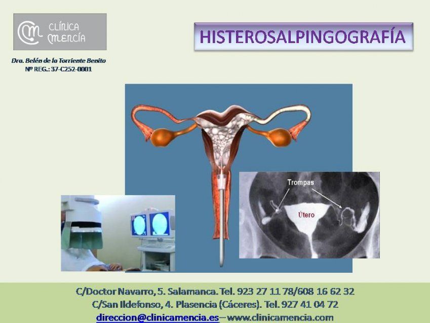 HSG HSG