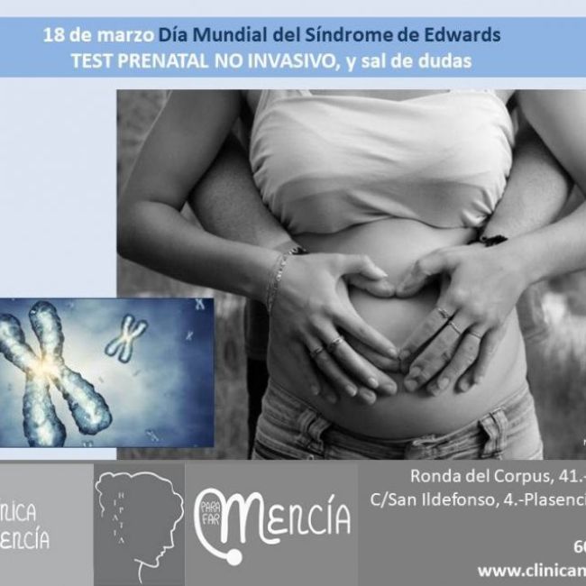 diapo Síndrome de Edwards