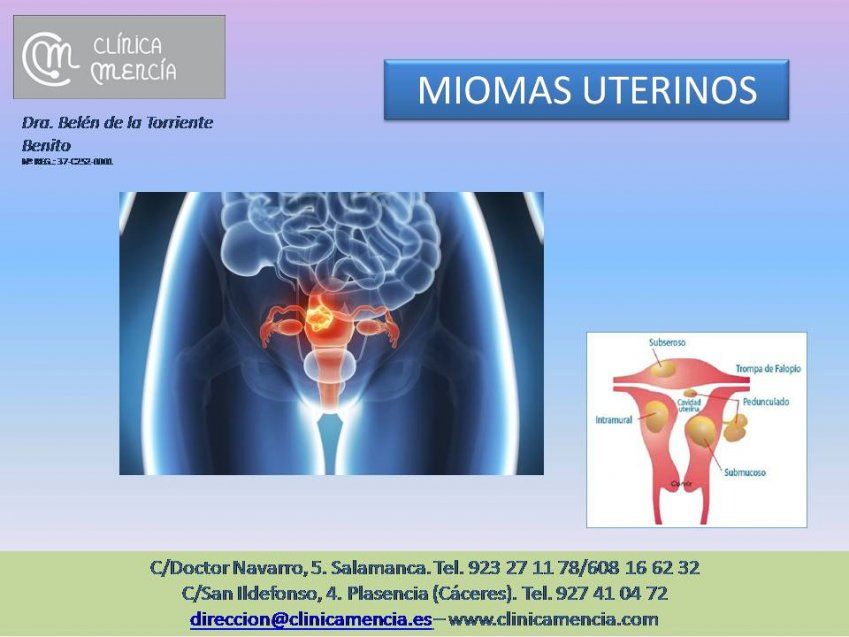 MIOMAS MIOMAS