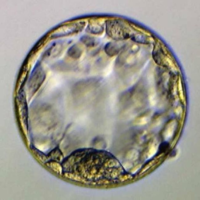 pruebas complementarias