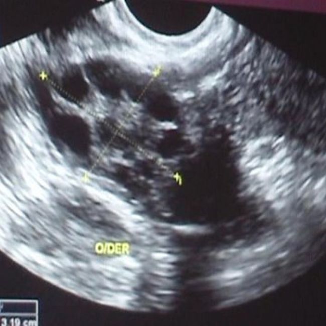 Endocrinología ginecológica