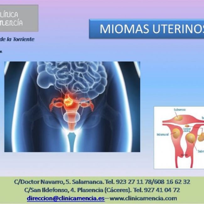 MIOMAS