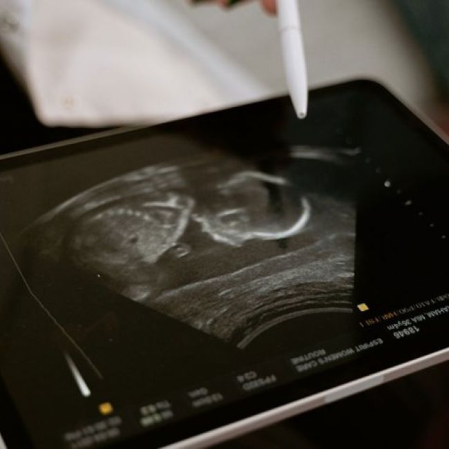 Diagnóstico prenatal