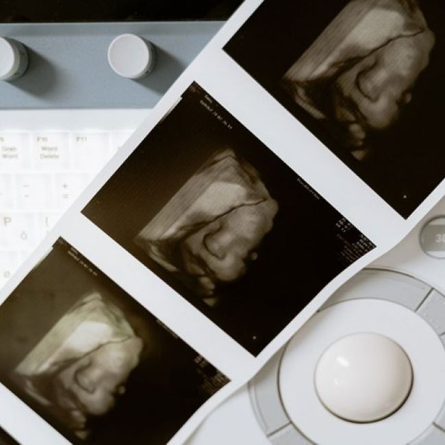 Seguimiento del embarazo