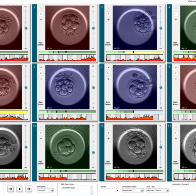 EmbryoScope