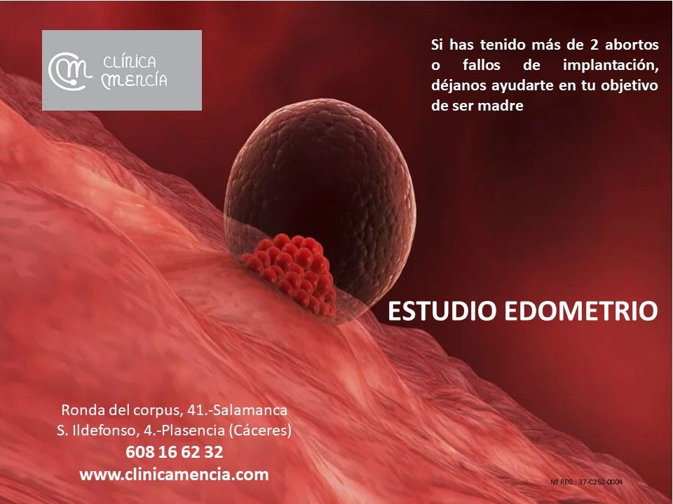 ESTUDIO ENDOMETRIO ESTUDIO ENDOMETRIO