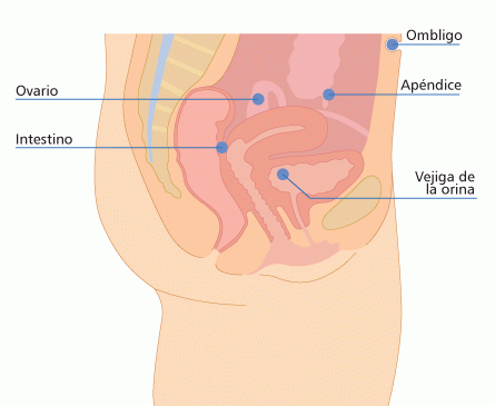 Endometriosis