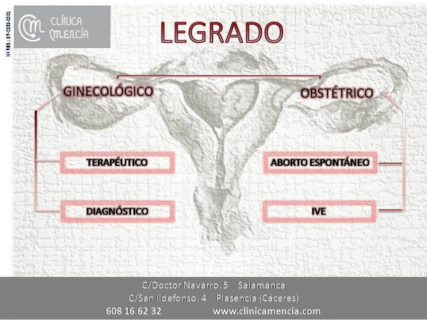 CLÍNICA MENCÍA TE INFORMA: LEGRADO UTERINO